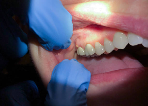 Best Emergency Treatment for Toothache in Womelsdorf, PA
