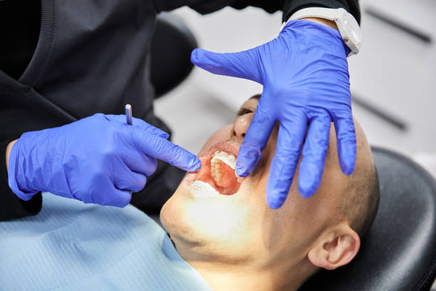 Best Emergency Wisdom Teeth Removal in Womelsdorf, PA